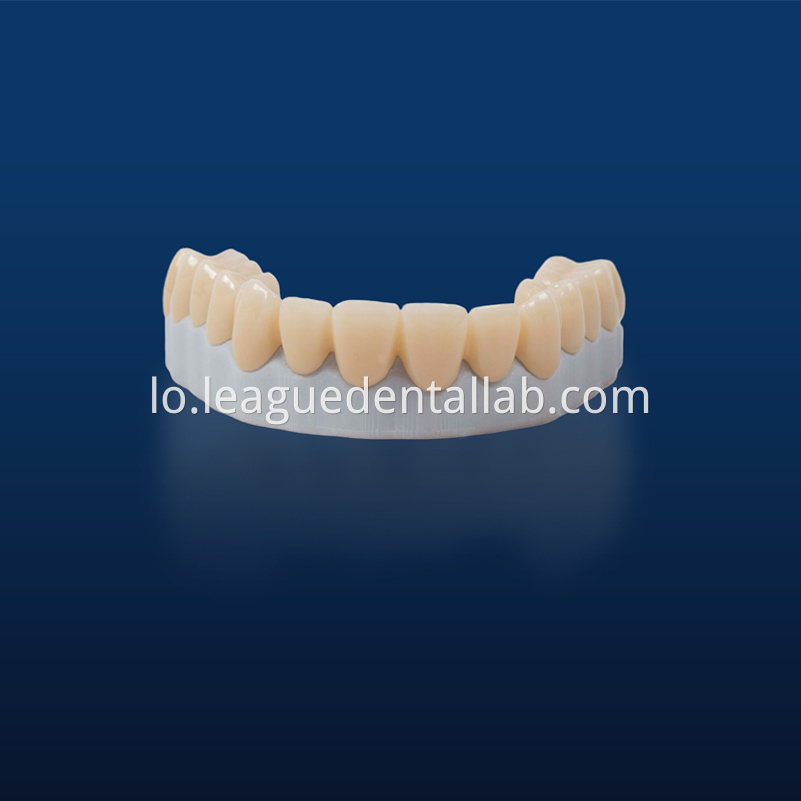 zirconia ເຕັມ Full Zirconia